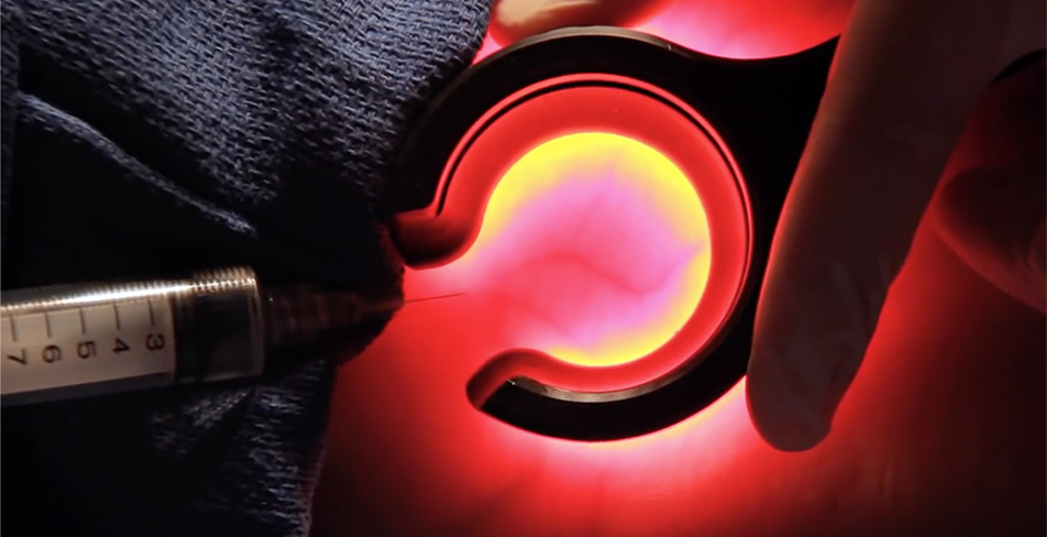 Veinlite Damar Yolu Bulmanın En Kolay Yolu Veinlite Ledx, Devlet Malzeme Ofisi, DMO, Damar Saptayıcı, Damar Saptama Cihazı, Damar Görüntüleme Cihazı, Damar Bulma Cihazı