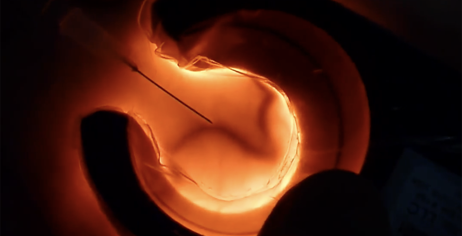 Veinlite Damar Yolu Bulmanın En Kolay Yolu Veinlite Ledx, Devlet Malzeme Ofisi, DMO, Damar Saptayıcı, Damar Saptama Cihazı, Damar Görüntüleme Cihazı, Damar Bulma Cihazı